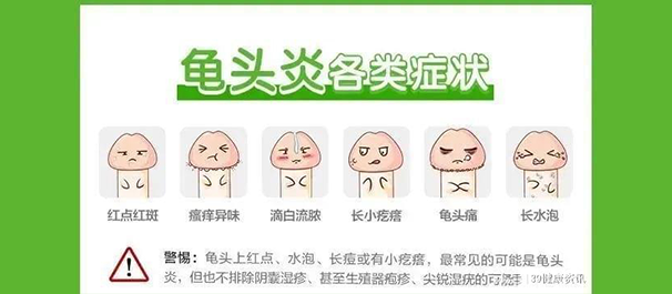 引起龟头炎常见病因是