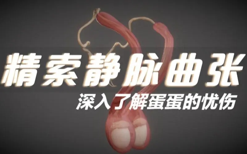 精索静脉曲张怎么预防好?