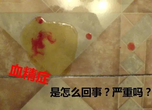 血精症是什么原因导致